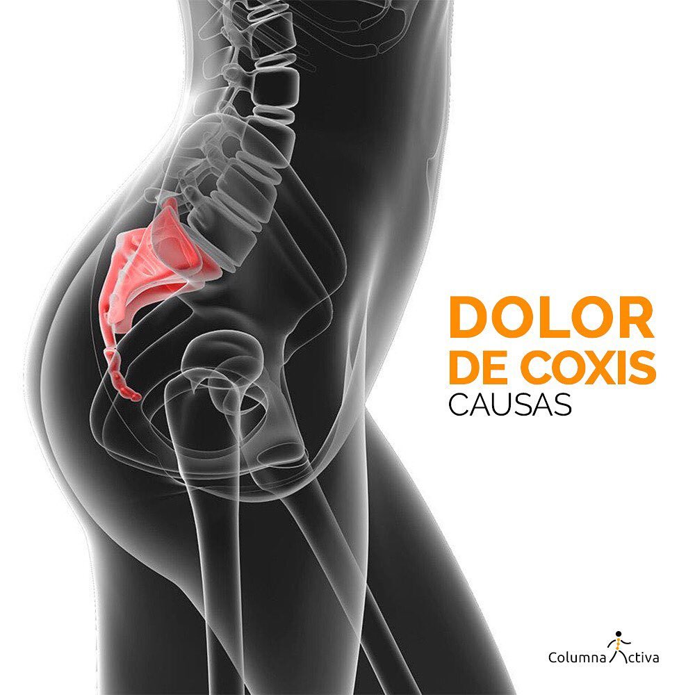 Los Cojines ideales para tu dolor de Coxis